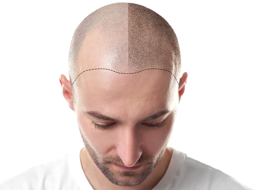 Esteba Clinic | Saç Pigmentasyonunu Korumanın Yolları